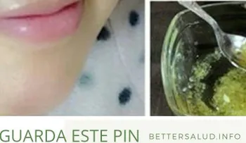 Para mujeres y hombres: Cómo usar el limón para quitar manchas de tu cara y tener una piel brillante