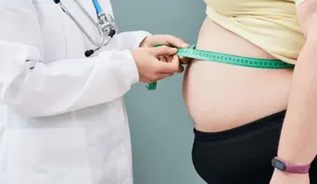 Obesidad afectará 40% del planeta en 2035
