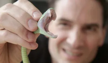 Este hombre es aficionado a inyectarse veneno de serpientes
