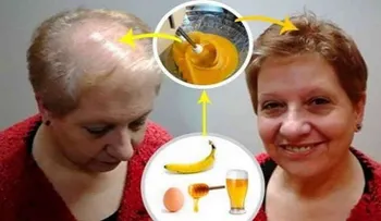 Truco para hacer crecer el cabello deja a todos los médicos con la boca abierta!!!