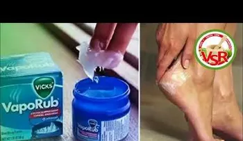 Sabías que el Vick Vaporub sirve para el pene y el ano