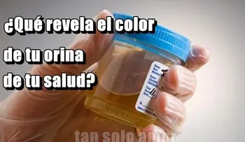 ¿Qué revela color de tu orina ?
