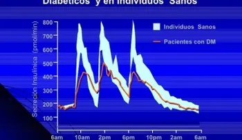 La insulinización oportuna es una estrategia contra el daño irreversible de la diabetes