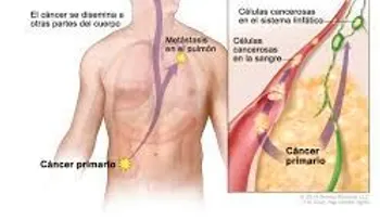 Científica Magdalena Paolino descubre cómo frenar metástasis del Cáncer