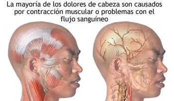 ¿Como solucionar, el dolor de cabeza constante?
