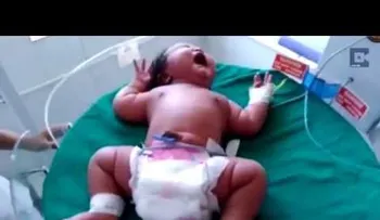 Nace la bebé más pesada del mundo, de 6,8 kilogramos (VIDEO)