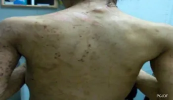Un caso de esclavitud: Fue encadenada dos años para obligarla a planchar ropa día y noche