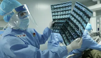 Coronavirus podría seguir en pulmones de pacientes recuperados, según estudio