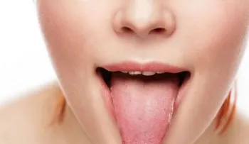 La lengua revela cómo está tu salud