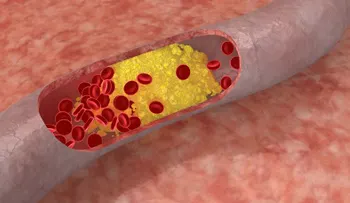 3 recomendaciones para mejorar tus ánalisis clínicos