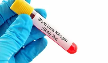 Los niveles de urea elevados en la sangre aumentan el riesgo de diabetes tipo 2
