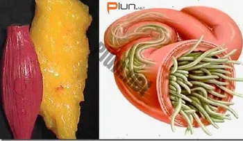 Con estos 2 ingredientes eliminé la grasa y parásitos de mi cuerpo como si nada