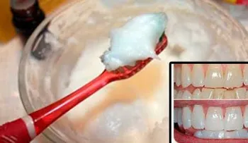 Termina con el mal aliento, el sarro y la placa con esta crema blanqueadora 