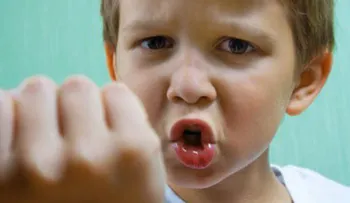 Bullying: ¿cómo contener la agresividad de un niño?