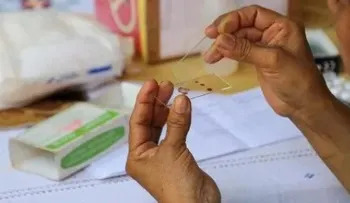 El impacto de COVID-19 en sistemas de salud puede elevar muertes por VIH o malaria