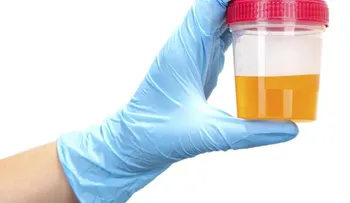 ¿Cómo se detecta la sangre en la orina?
