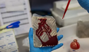 Investigadora se infecta accidentalmente de zika