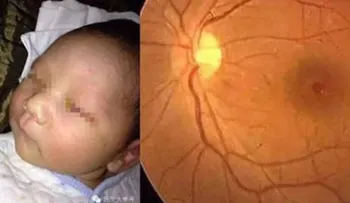 Es real la historia del bebé que quedó ciego tras tomarle una foto con flash?