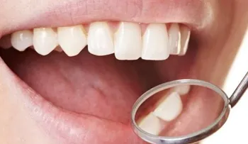 Las infecciones en boca pueden causar desde amigdalitis a cardiopatías