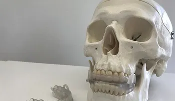 Investigadores crean un dispositivo bucal que previene los ronquidos y la apnea del sueño