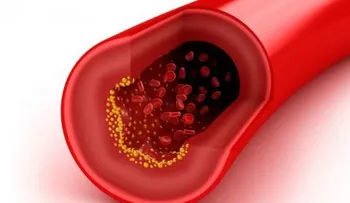 El colesterol bueno o HDL en la sangre no siempre es saludable para el corazón