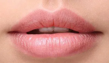 Soluciones para evitar los labios partidos 