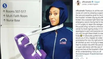 La cantante Mel B se fractura dos costillas y una de sus manos