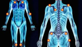 5 síntomas tempranos de la fibromialgia