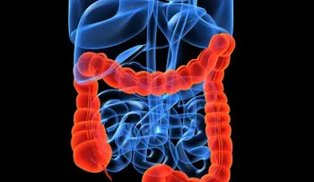 5 remedios naturales para limpiar el colon