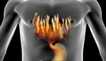 Si siente un dolor con ardor en la zona inferior del tórax es una acidez estomacal