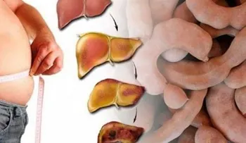 Si consume esta fruta el hígado graso desaparece por COMPLETO