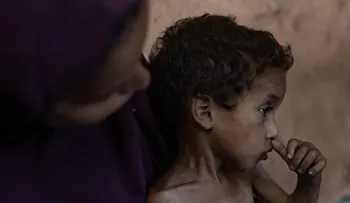 Desnutrición acaba con la vida de cinco gazatíes, entre ellos un bebé y dos niños, en 24 horas