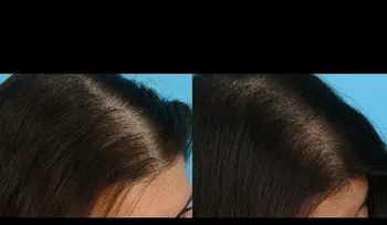 La solución a mi caída de Cabello (VIDEO)
