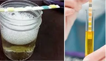 Los problemas de salud si la orina hace espuma!