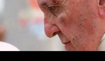 El papa Francisco se golpea el rostro en el papamóvil