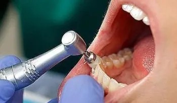 Personas con demencia tienen peor salud oral 