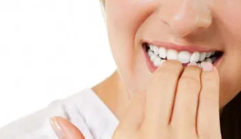 ¿Te comes las uñas? Lee estos trucos para que no lo hagas más