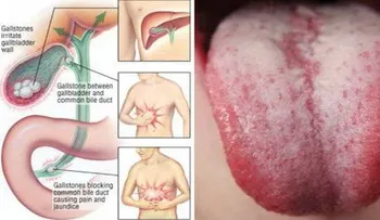 Necesitas eliminar las toxinas de tu cuerpo si notas estas señales de advertencia