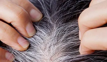Descubre que las canas te salvan de un cáncer