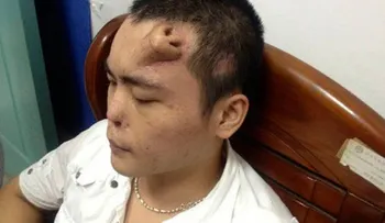 Mata a médico porque no le gustó el resultado de su operación de nariz 