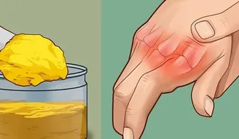 ¿Te duelen las manos y las articulaciones? Haz esto una sola vez y listoâ?¦ !Dile adiós al dolor