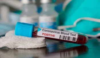 EEUU autoriza prueba de coronavirus da resultado en 45 minutos