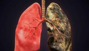 ¿Estás perdiendo capacidad pulmonar?