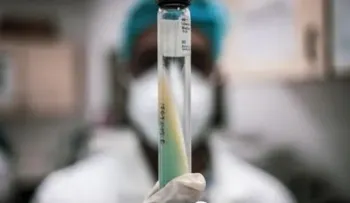 La pandemia del coronavirus disparó las muertes por tuberculosis en 2020 