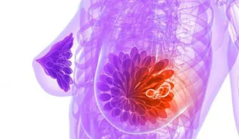 Un avance que ayudará a predecir el pronóstico de los tumores de mama