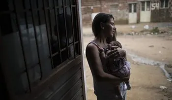 Aumentan casos de microcefalia en Brasil: vínculo con zika