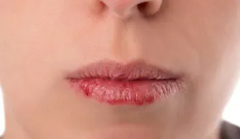 Si estás perdiendo el cabello o tienes la piel reseca es porque te falta 1 de estas vitaminas