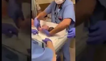 Un médico deja caer a un bebé en pleno parto y sufrió una hemorragia cerebral
