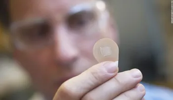 Un parche cutáneo podría ser el futuro de la vacuna contra la gripe, dice este estudio