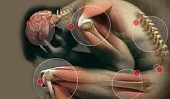¿Es la osteoartritis un problema metabólico? 